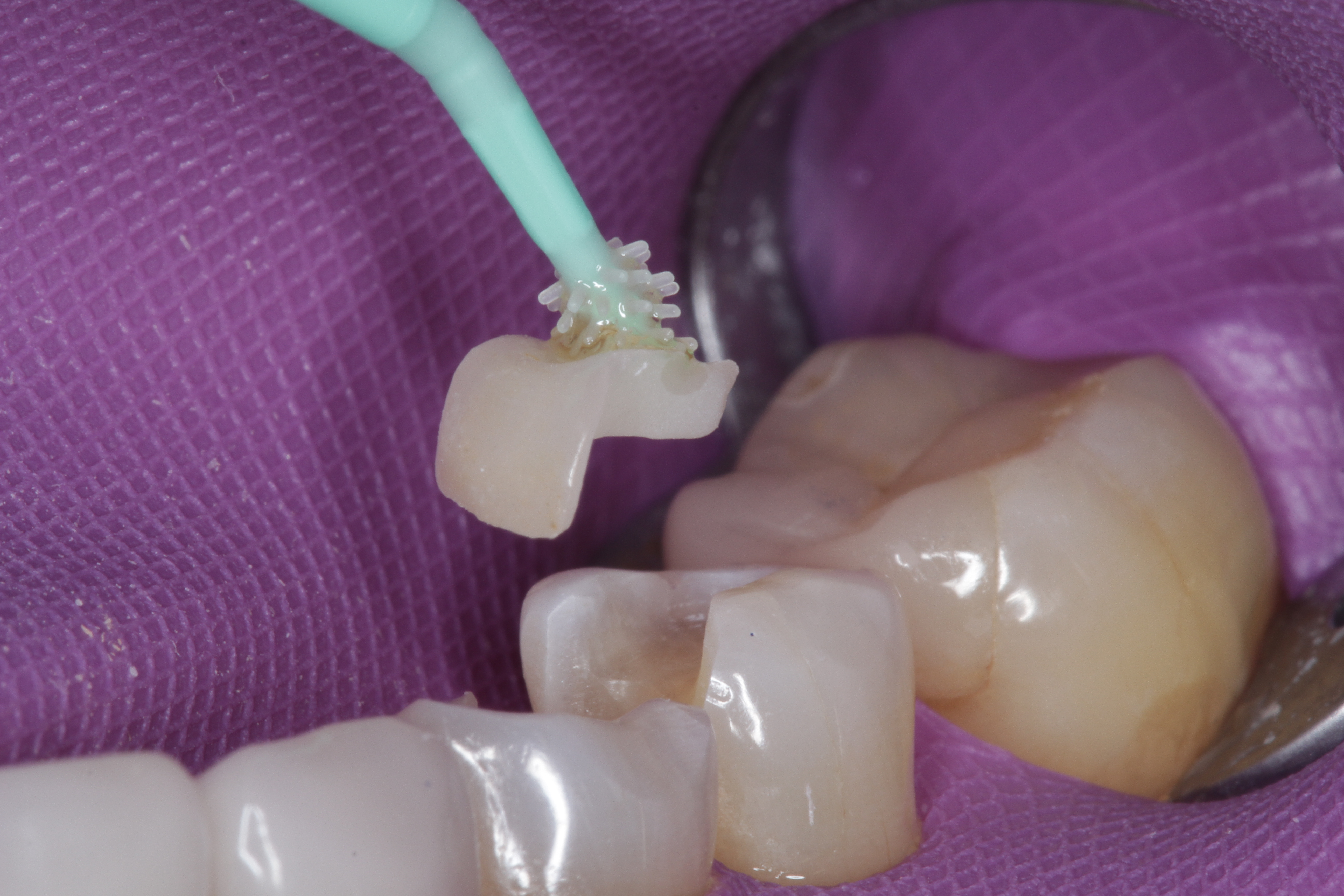 ZerofloX Beschnidt Abb2