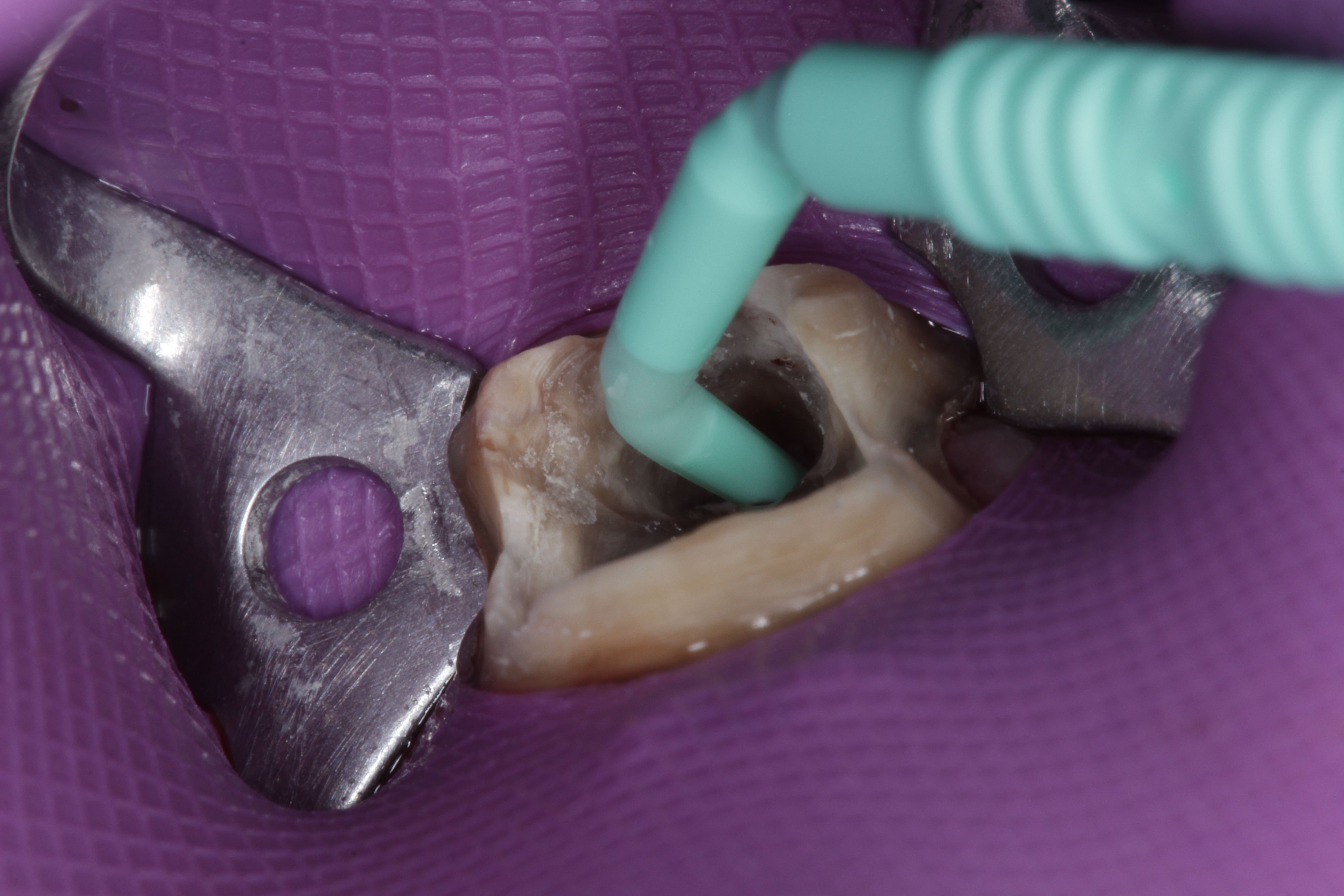 ZerofloX Beschnidt Abb1